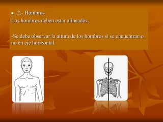  2.- Hombros
Los hombros deben estar alineados.
-Se debe observar la altura de los hombros si se encuentran o
no en eje horizontal.
 