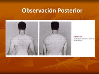Observación Posterior
 