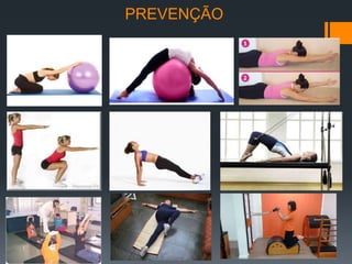 PREVENÇÃO
 