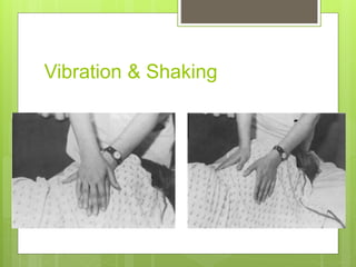 Vibration & Shaking
 