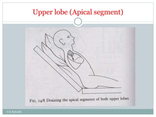 Upper lobe (Apical segment)
G K Subudhi
 