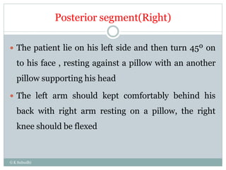Posterior segment(Right)
G K Subudhi
 The patient lie on his left side and then turn 45º on
to his face , resting against a pillow with an another
pillow supporting his head
 The left arm should kept comfortably behind his
back with right arm resting on a pillow, the right
knee should be flexed
 