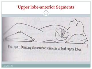 Upper lobe-anterior Segments
G K Subudhi
 