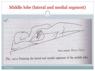 Middle lobe (lateral and medial segment)
G K Subudhi
 