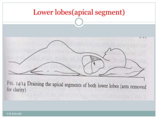 Lower lobes(apical segment)
G K Subudhi
 
