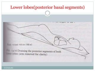 Lower lobes(posterior basal segments)
G K Subudhi
 