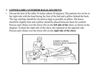  LOWER LOBE (ANTERIOR BASALSEGMENT)
• Elevate the foot of the table 18 inches (about 30 degrees). The patients lies on his or
her right side with the head facing the foot of the bed and a pillow behind the back.
The legs and hips should be elevated as high as possible on pillow. The knees
should be slightly bent and a pillow should be placed between them for comfort.
Percuss and vibrate over the lower ribs on the left side of the chest, as shown in the
diagram. To drain the right side of the chest, this repeated on the opposite side .
Percuss and vibrate over the lower ribs on the right side of the chest.
 