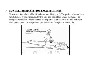  LOWER LOBES (POSTERIOR BASALSEGMENTS)
• Elevate the foot of the table 18 inches(about 30 degrees). The patients lies on his or
her abdomen, with a pillow under the hips and one pillow under the head. The
caregiver percuss and vibrate at the lower part of the back over the left and right
sides of the spine. Do not percuss or vibrate over the spine or lower ribs.
 