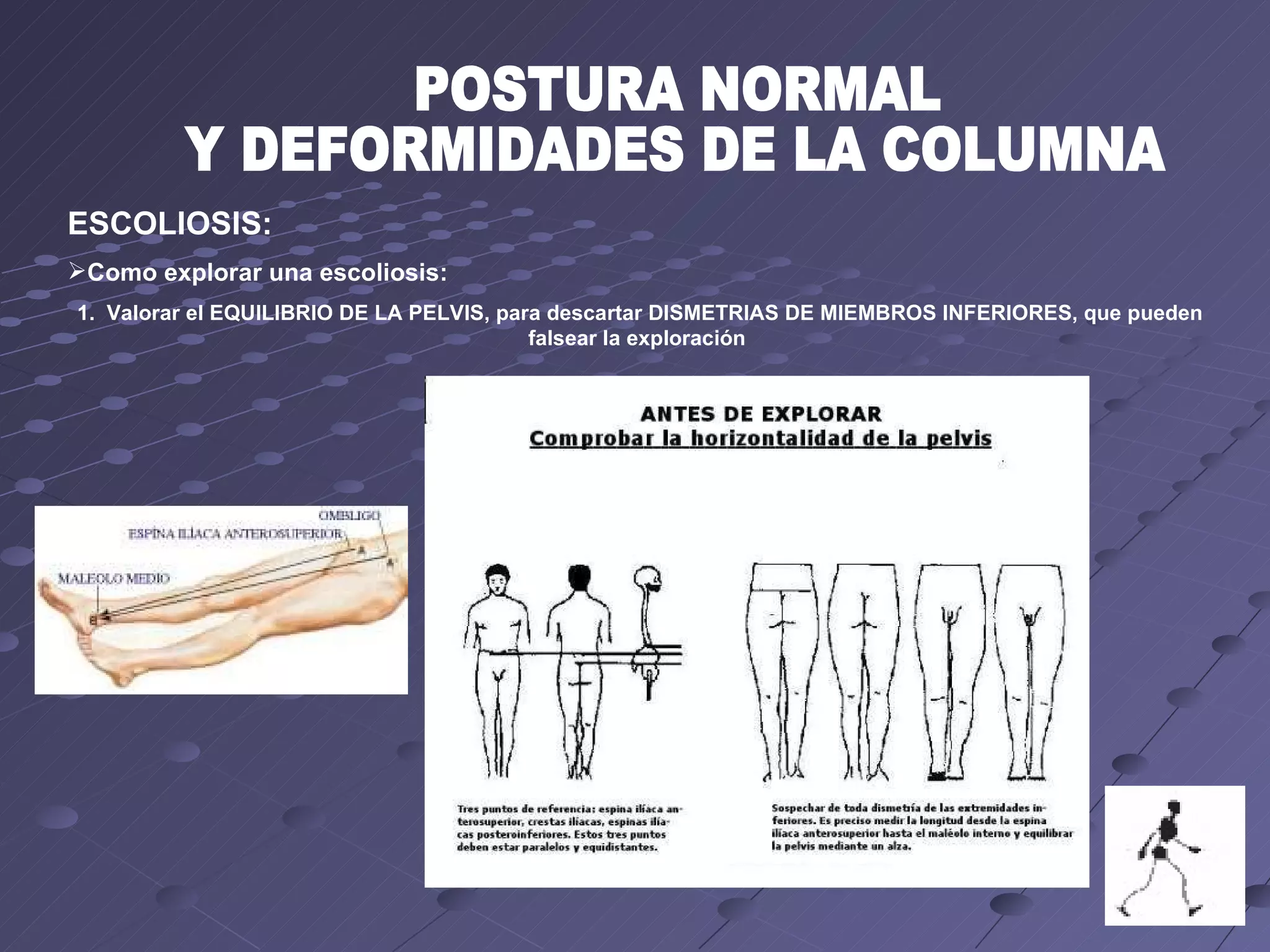 Postura normal y_deformidades_de_la_columna[1] | PPT