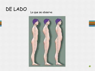 DE LADO
Lo que se observa
 