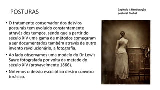 POSTURAS
• O tratamento conservador dos desvios
posturais tem evoluído constantemente
através dos tempos, sendo que a partir do
século XIV uma gama de métodos começaram
a ser documentados também através de outro
invento revolucionário, a fotografia.
• Ao lado observamos uma modelo do Dr Lewis
Sayre fotografada por volta da metade do
século XIV (provavelmente 1866).
• Notemos o desvio escoliótico destro convexo
torácico.
Capítulo I: Reeducação
postural Global
 