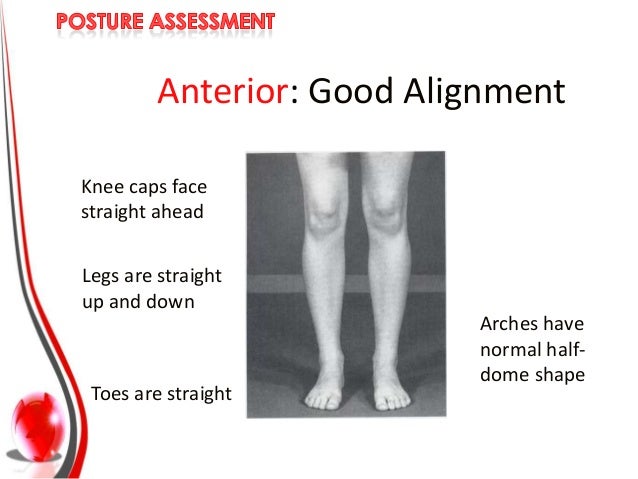 types of postures