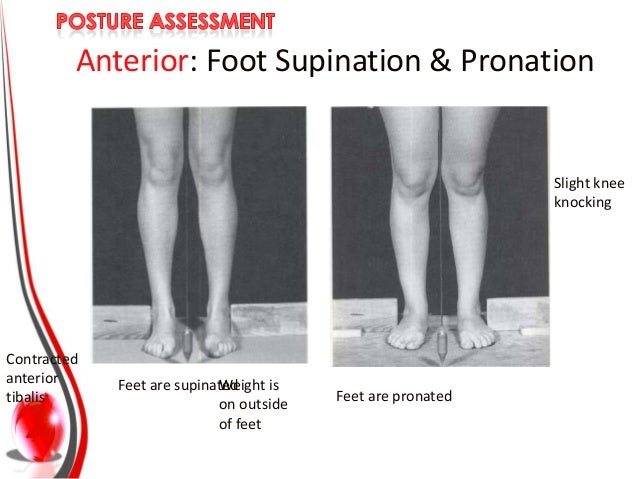 types of postures
