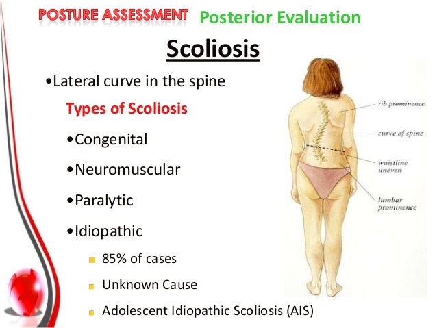 types of postures