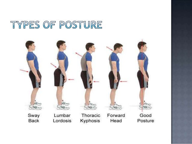 types of postures