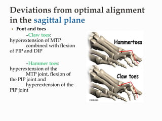 Toe Pip posture-biomechanics, kinetic and kinematics of posture, postural ...