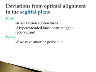 Knee
–Knee flexion contractures
–Hyperextended knee posture (genu
recurvatum)
Pelvis
–Excessive anterior pelvic tilt
 