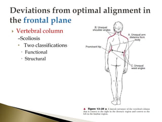  Vertebral column
–Scoliosis
• Two classifications
 Functional
 Structural
 