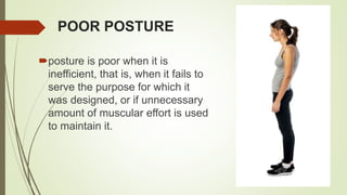 POOR POSTURE
posture is poor when it is
inefficient, that is, when it fails to
serve the purpose for which it
was designed, or if unnecessary
amount of muscular effort is used
to maintain it.
 