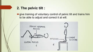 give training of voluntary control of pelvic tilt and trains him
to be able to adjust and correct it at will.
2. The pelvic tilt :
 