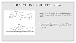 POSTURE.pptx