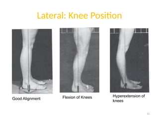 Various posture and spinal deformities.pptx