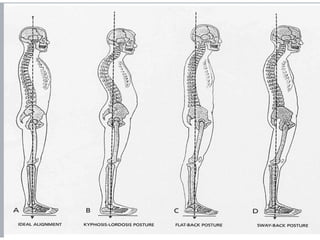 Abnormal Posture Types Comprehensive Guide to Posture: Types, Assessment, and Abnormalities | PPTX