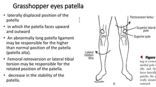 Posture copy | PPT