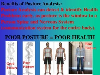 Benefits of Posture Analysis:
Posture Analysis can detect & identify Health
Problems early, as posture is the window to a
Person Spine and Nervous System
(communication system for the entire body).

POOR POSTURE = POOR HEALTH
Poor
Posture

Good
Posture

Poor
Posture

 