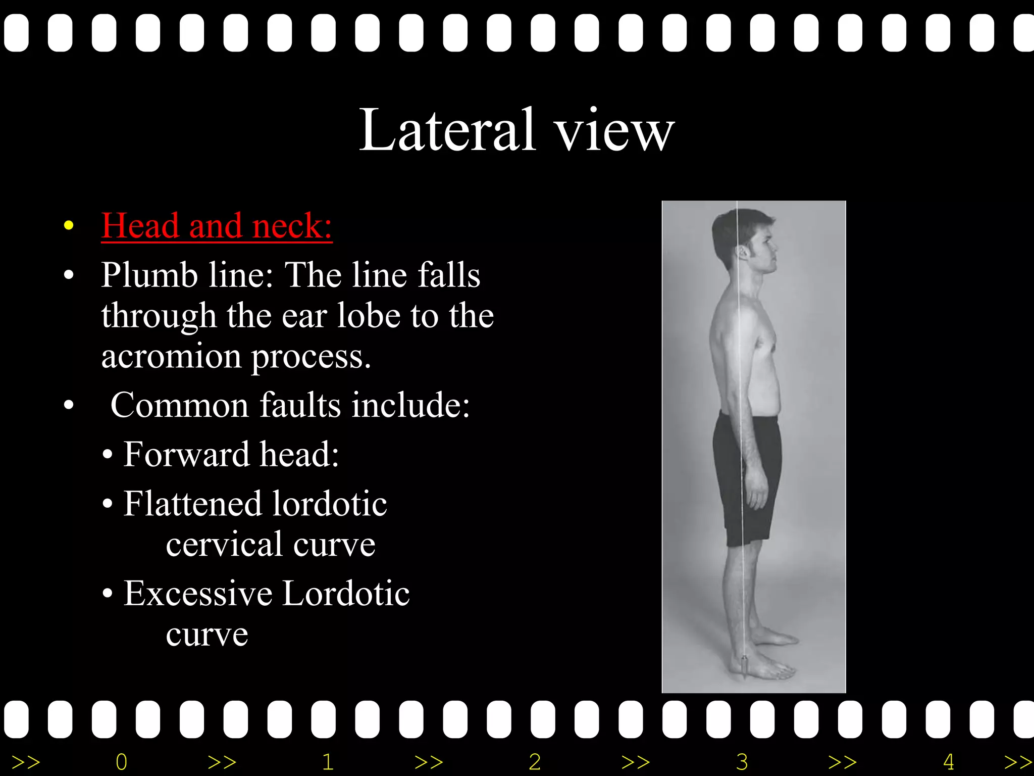 >> 0 >> 1 >> 2 >> 3 >> 4 >>
Lateral view
• Head and neck:
• Plumb line: The line falls
through the ear lobe to the
acromion process.
• Common faults include:
• Forward head:
• Flattened lordotic
cervical curve
• Excessive Lordotic
curve
 