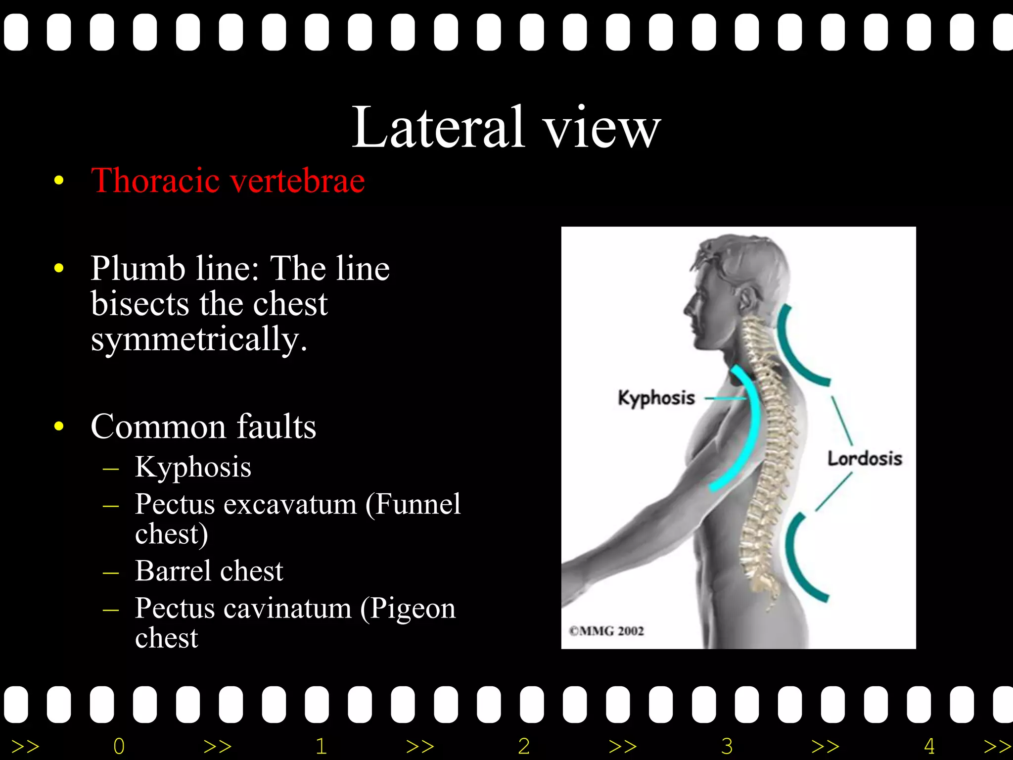 >> 0 >> 1 >> 2 >> 3 >> 4 >>
Lateral view
• Thoracic vertebrae
• Plumb line: The line
bisects the chest
symmetrically.
• Common faults
– Kyphosis
– Pectus excavatum (Funnel
chest)
– Barrel chest
– Pectus cavinatum (Pigeon
chest
 