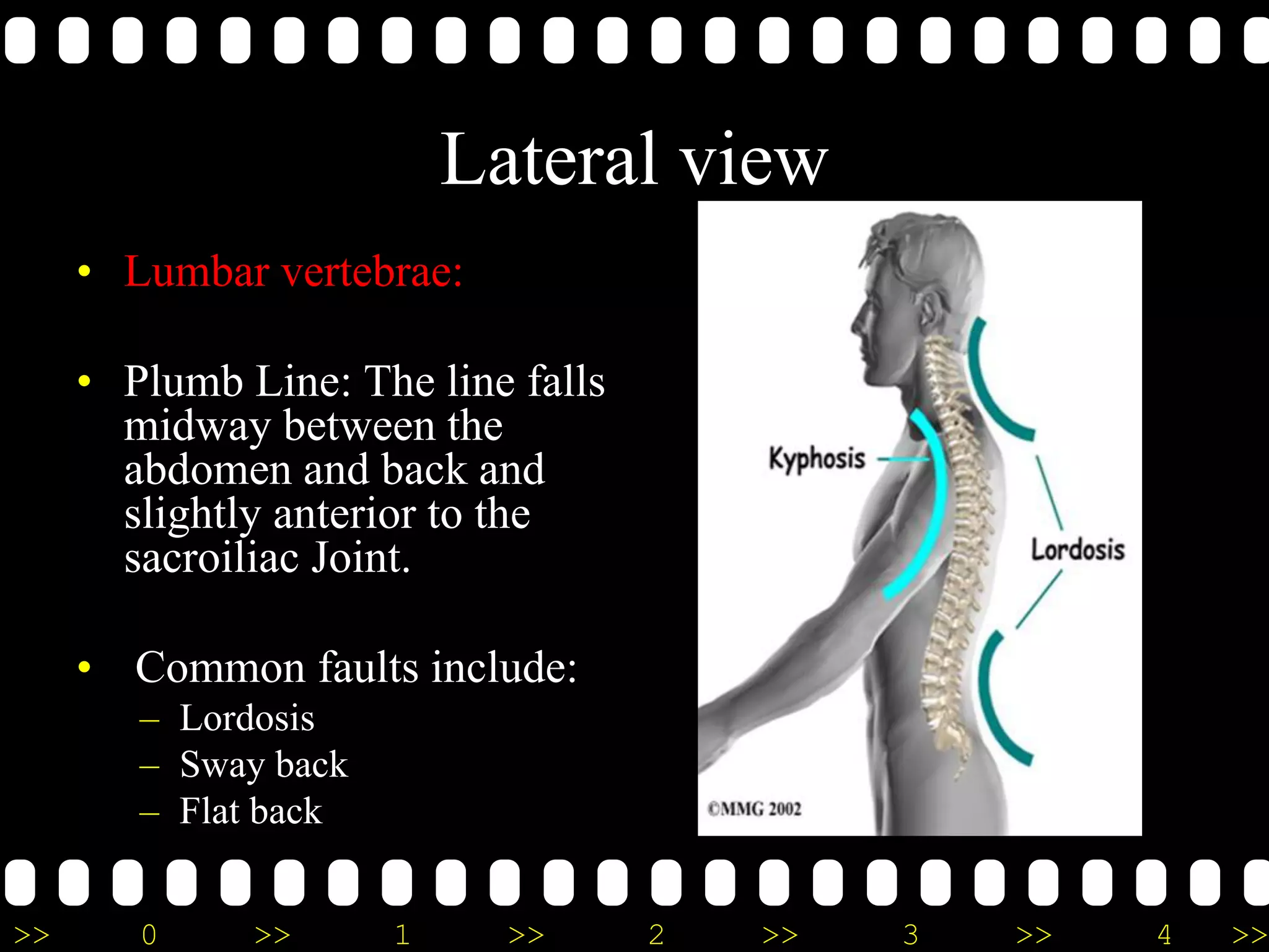 >> 0 >> 1 >> 2 >> 3 >> 4 >>
Lateral view
• Lumbar vertebrae:
• Plumb Line: The line falls
midway between the
abdomen and back and
slightly anterior to the
sacroiliac Joint.
• Common faults include:
– Lordosis
– Sway back
– Flat back
 