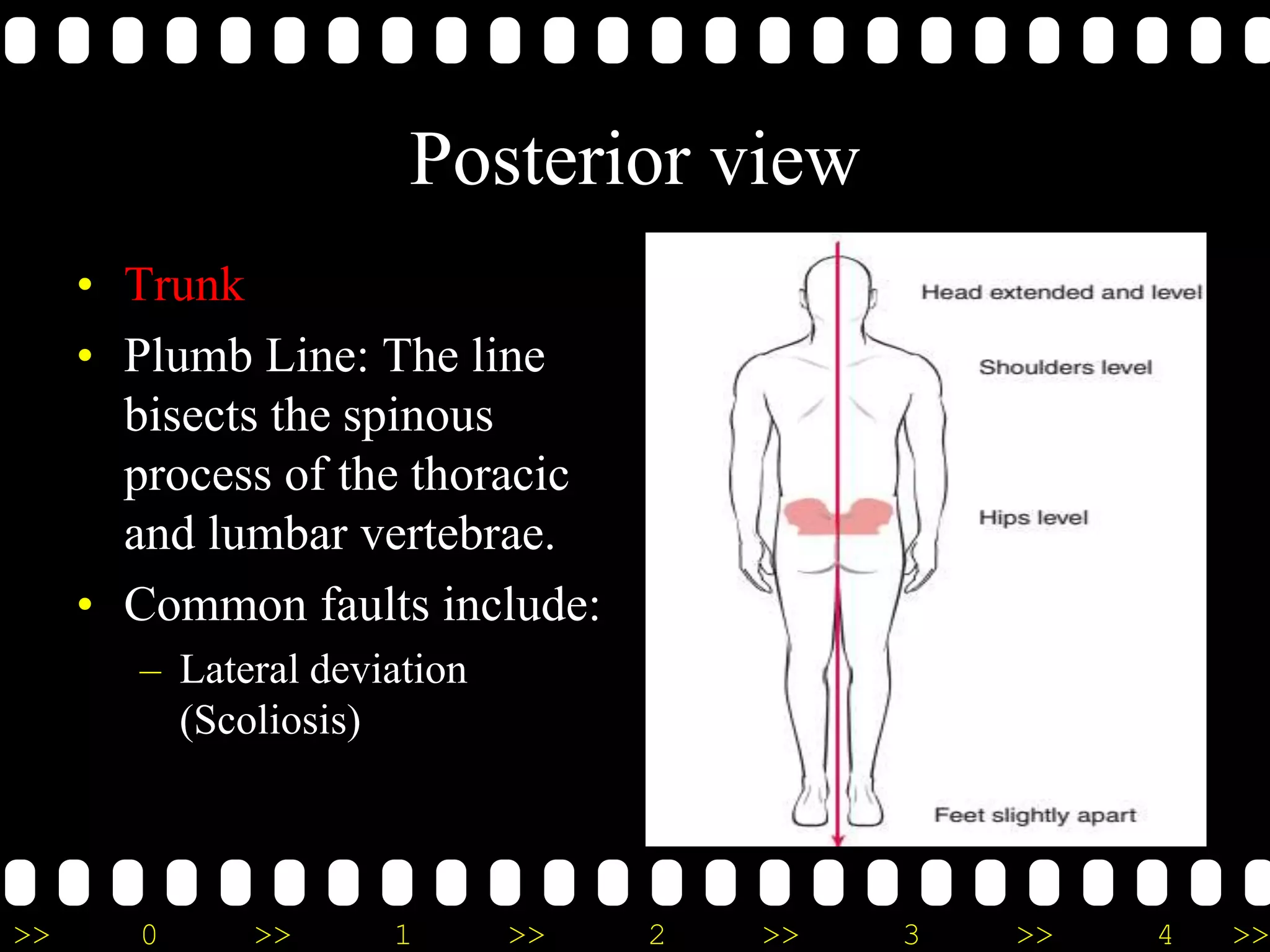 >> 0 >> 1 >> 2 >> 3 >> 4 >>
Posterior view
• Trunk
• Plumb Line: The line
bisects the spinous
process of the thoracic
and lumbar vertebrae.
• Common faults include:
– Lateral deviation
(Scoliosis)
 