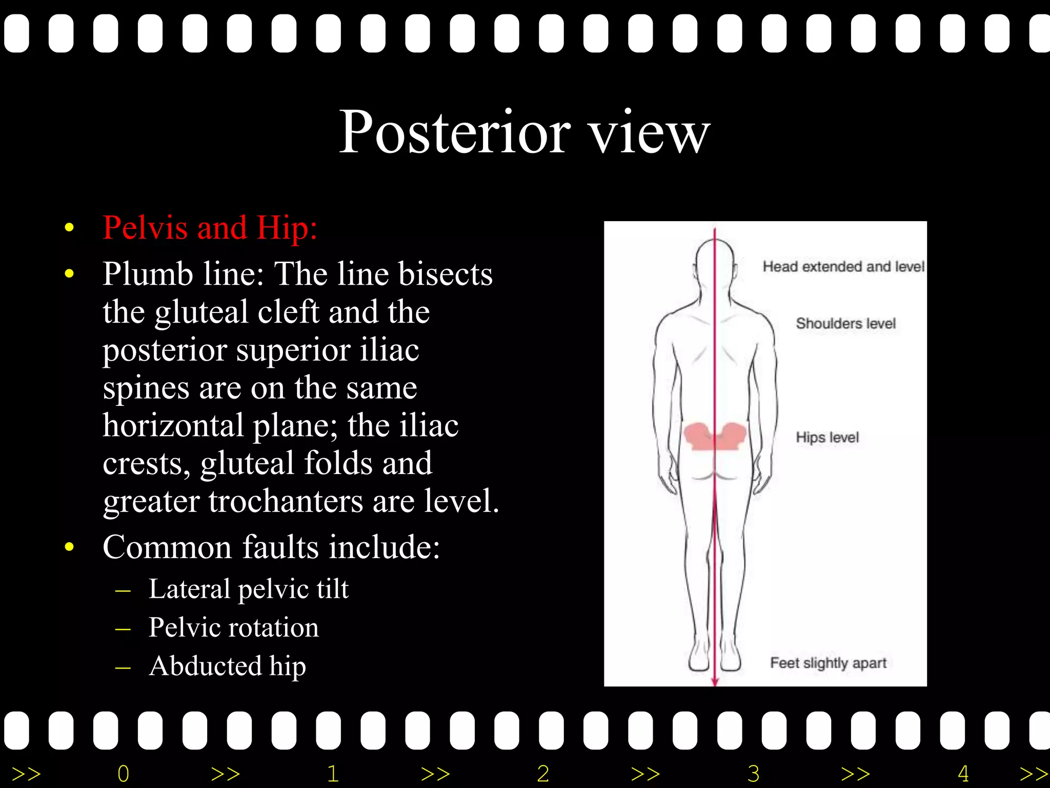 >> 0 >> 1 >> 2 >> 3 >> 4 >>
Posterior view
• Pelvis and Hip:
• Plumb line: The line bisects
the gluteal cleft and the
posterior superior iliac
spines are on the same
horizontal plane; the iliac
crests, gluteal folds and
greater trochanters are level.
• Common faults include:
– Lateral pelvic tilt
– Pelvic rotation
– Abducted hip
 