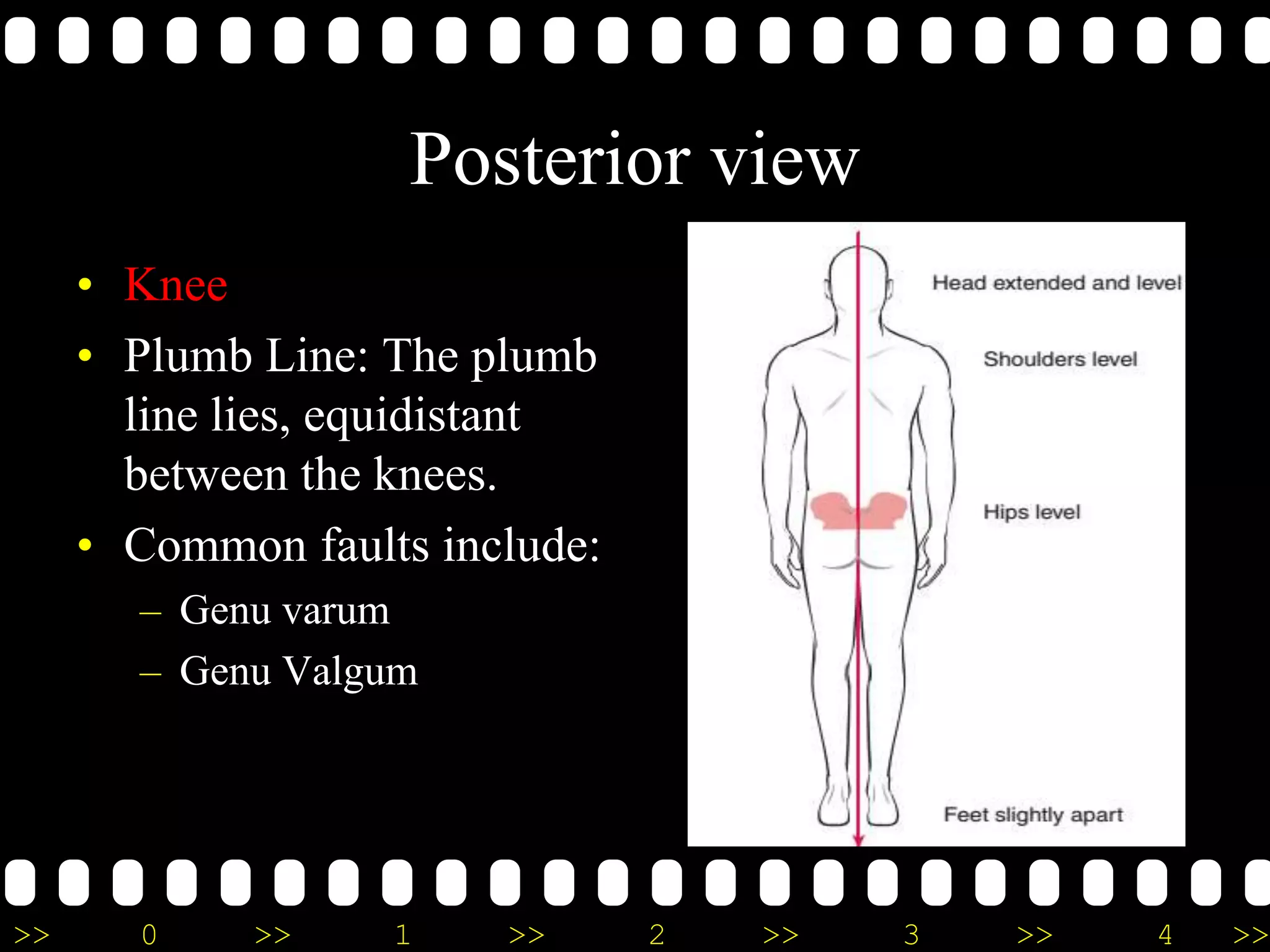 >> 0 >> 1 >> 2 >> 3 >> 4 >>
Posterior view
• Knee
• Plumb Line: The plumb
line lies, equidistant
between the knees.
• Common faults include:
– Genu varum
– Genu Valgum
 