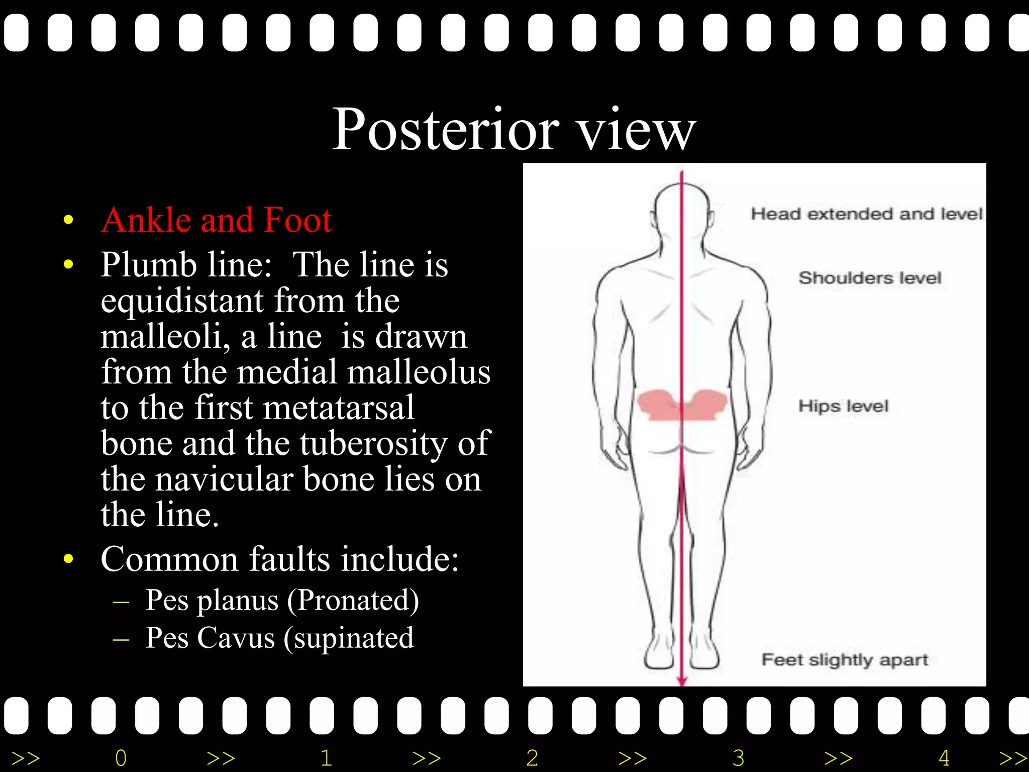 >> 0 >> 1 >> 2 >> 3 >> 4 >>
Posterior view
• Ankle and Foot
• Plumb line: The line is
equidistant from the
malleoli, a line is drawn
from the medial malleolus
to the first metatarsal
bone and the tuberosity of
the navicular bone lies on
the line.
• Common faults include:
– Pes planus (Pronated)
– Pes Cavus (supinated
 