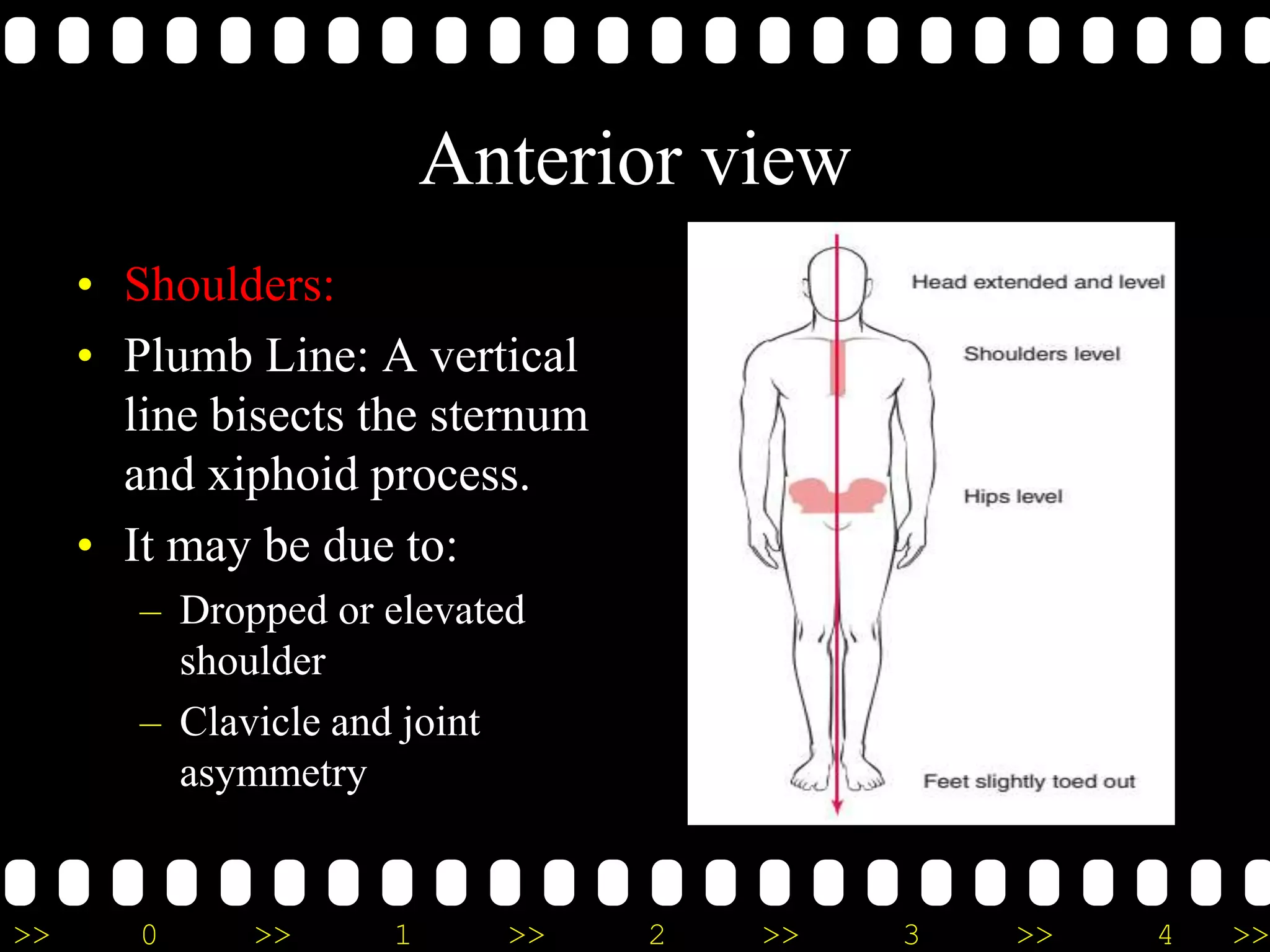 >> 0 >> 1 >> 2 >> 3 >> 4 >>
Anterior view
• Shoulders:
• Plumb Line: A vertical
line bisects the sternum
and xiphoid process.
• It may be due to:
– Dropped or elevated
shoulder
– Clavicle and joint
asymmetry
 