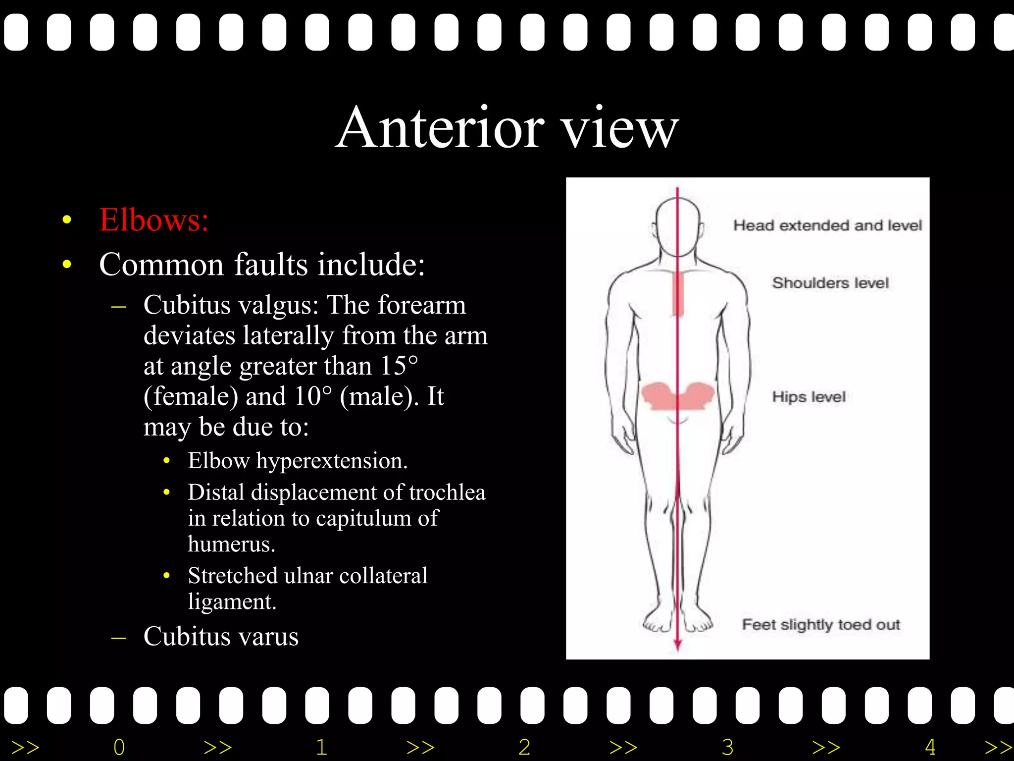 >> 0 >> 1 >> 2 >> 3 >> 4 >>
Anterior view
• Elbows:
• Common faults include:
– Cubitus valgus: The forearm
deviates laterally from the arm
at angle greater than 15°
(female) and 10° (male). It
may be due to:
• Elbow hyperextension.
• Distal displacement of trochlea
in relation to capitulum of
humerus.
• Stretched ulnar collateral
ligament.
– Cubitus varus
 
