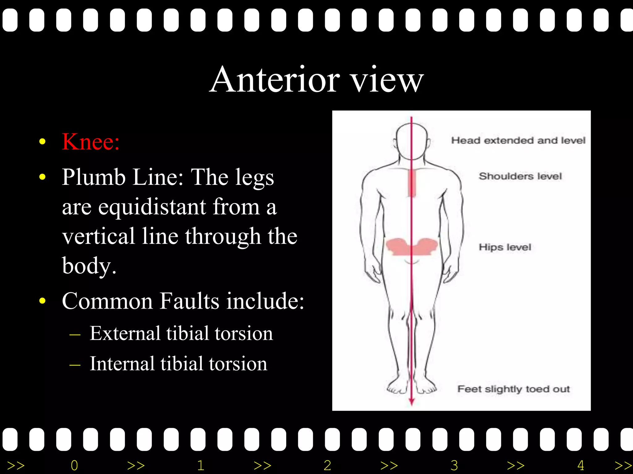 >> 0 >> 1 >> 2 >> 3 >> 4 >>
Anterior view
• Knee:
• Plumb Line: The legs
are equidistant from a
vertical line through the
body.
• Common Faults include:
– External tibial torsion
– Internal tibial torsion
 