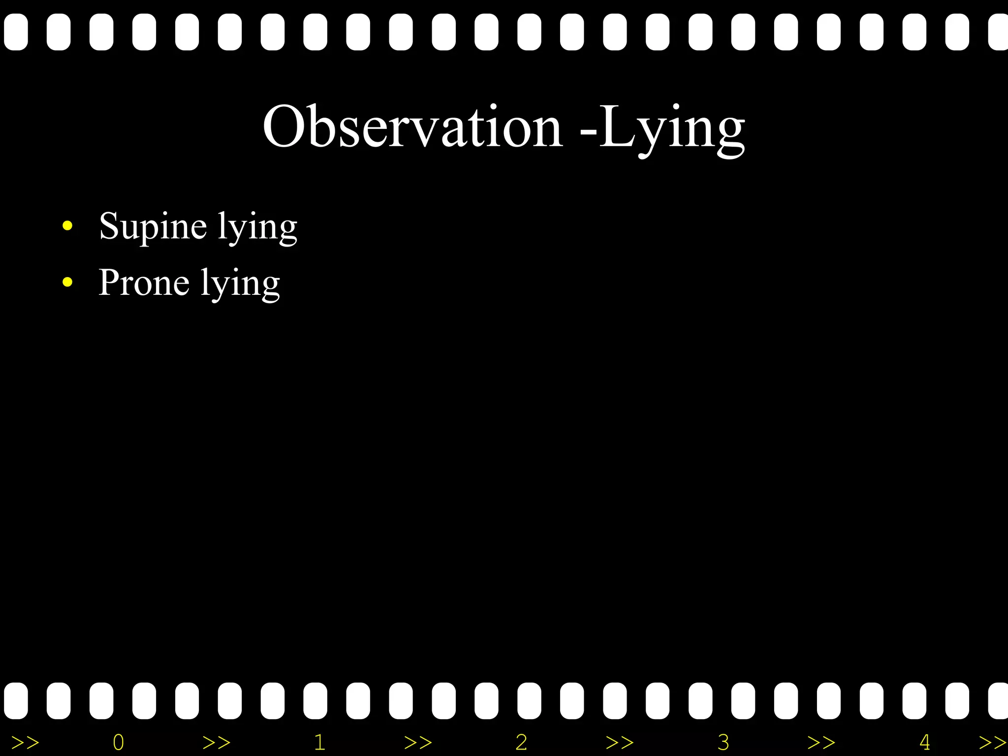 >> 0 >> 1 >> 2 >> 3 >> 4 >>
Observation -Lying
• Supine lying
• Prone lying
 