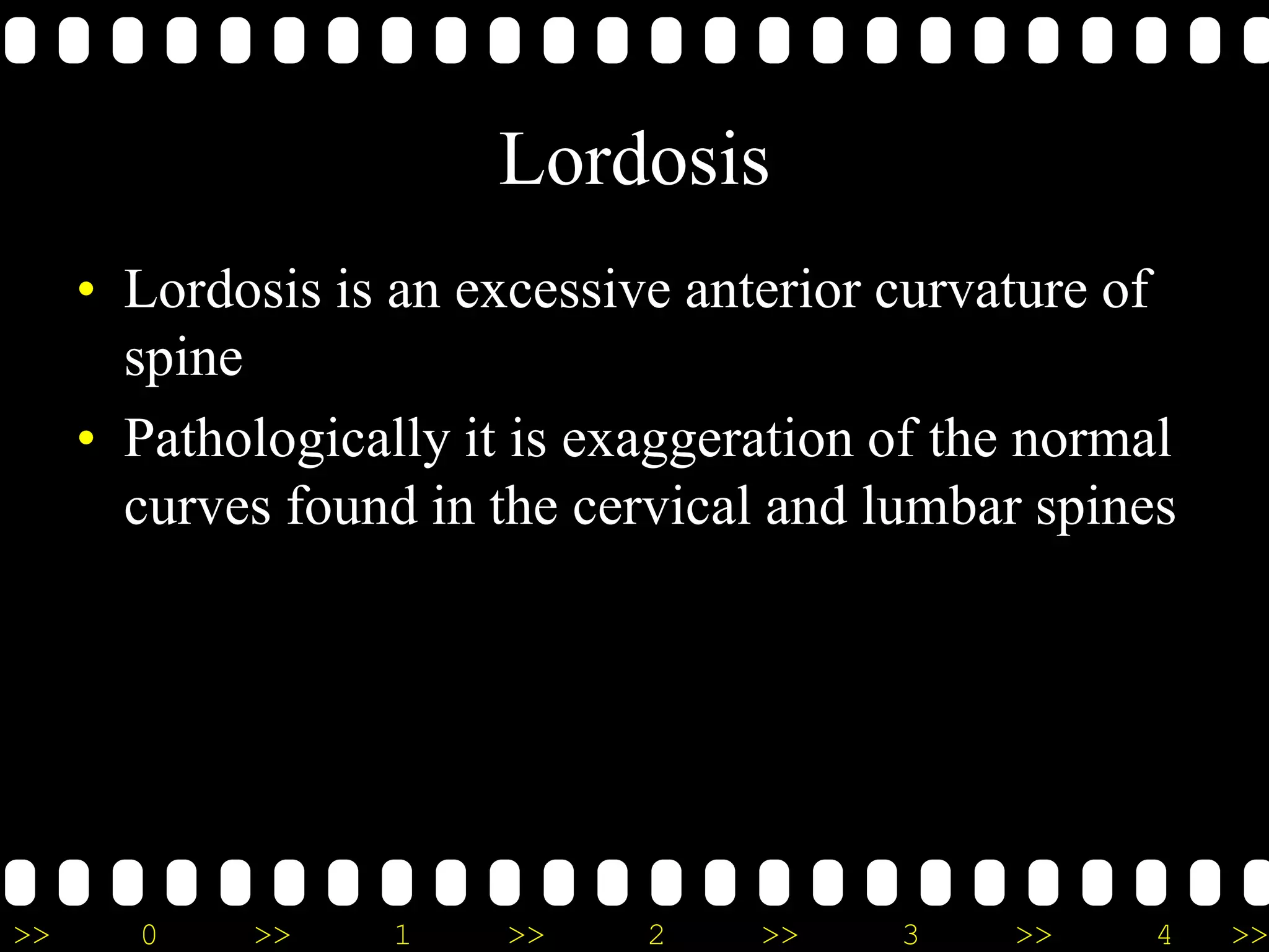 >> 0 >> 1 >> 2 >> 3 >> 4 >>
Lordosis
• Lordosis is an excessive anterior curvature of
spine
• Pathologically it is exaggeration of the normal
curves found in the cervical and lumbar spines
 