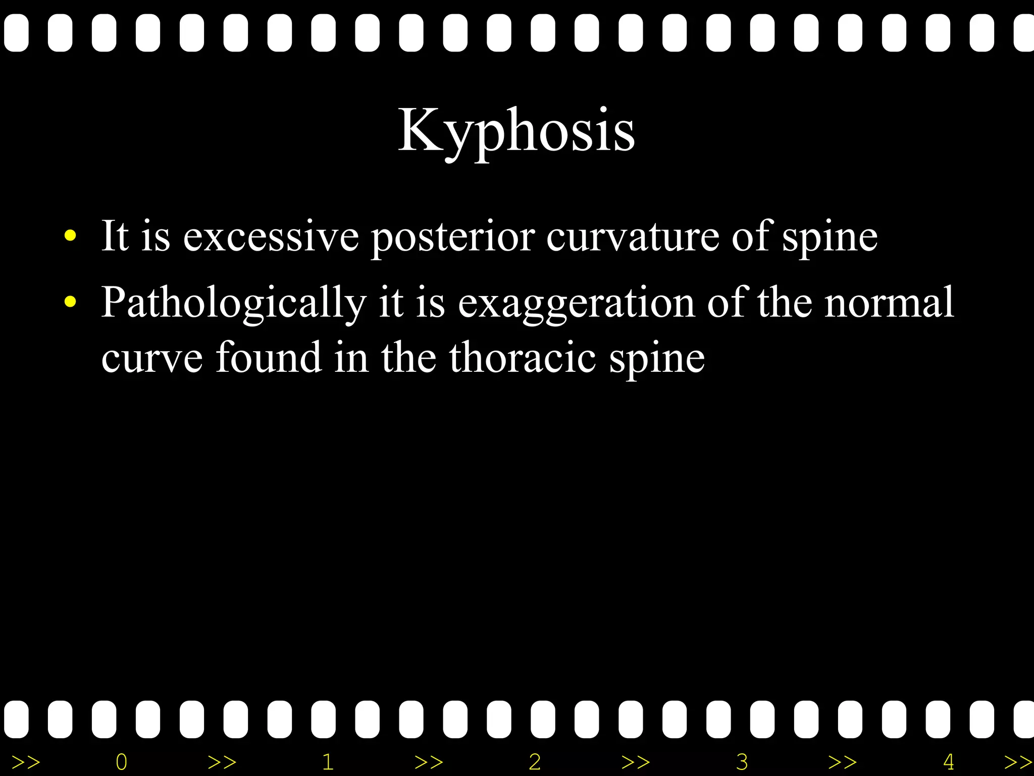 >> 0 >> 1 >> 2 >> 3 >> 4 >>
Kyphosis
• It is excessive posterior curvature of spine
• Pathologically it is exaggeration of the normal
curve found in the thoracic spine
 