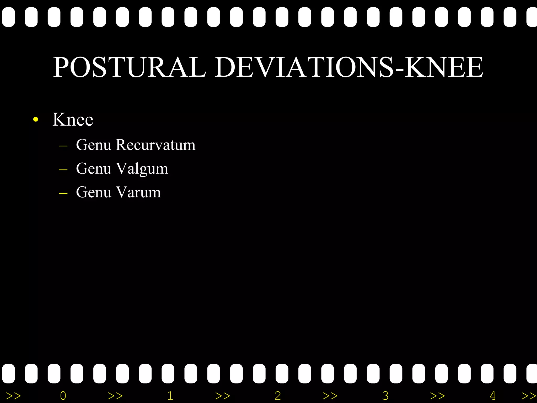 >> 0 >> 1 >> 2 >> 3 >> 4 >>
POSTURAL DEVIATIONS-KNEE
• Knee
– Genu Recurvatum
– Genu Valgum
– Genu Varum
 