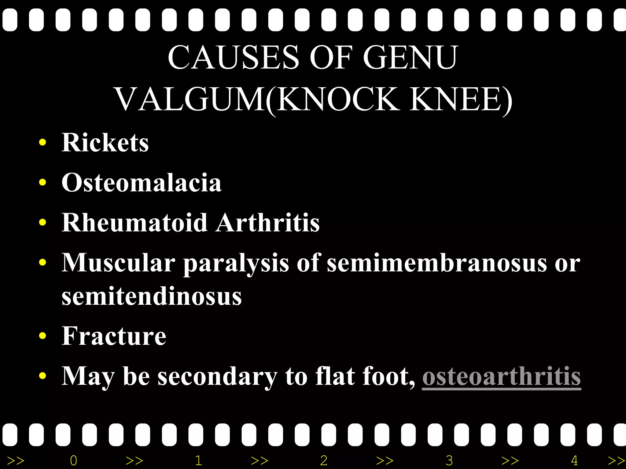 >> 0 >> 1 >> 2 >> 3 >> 4 >>
CAUSES OF GENU
VALGUM(KNOCK KNEE)
• Rickets
• Osteomalacia
• Rheumatoid Arthritis
• Muscular paralysis of semimembranosus or
semitendinosus
• Fracture
• May be secondary to flat foot, osteoarthritis
 