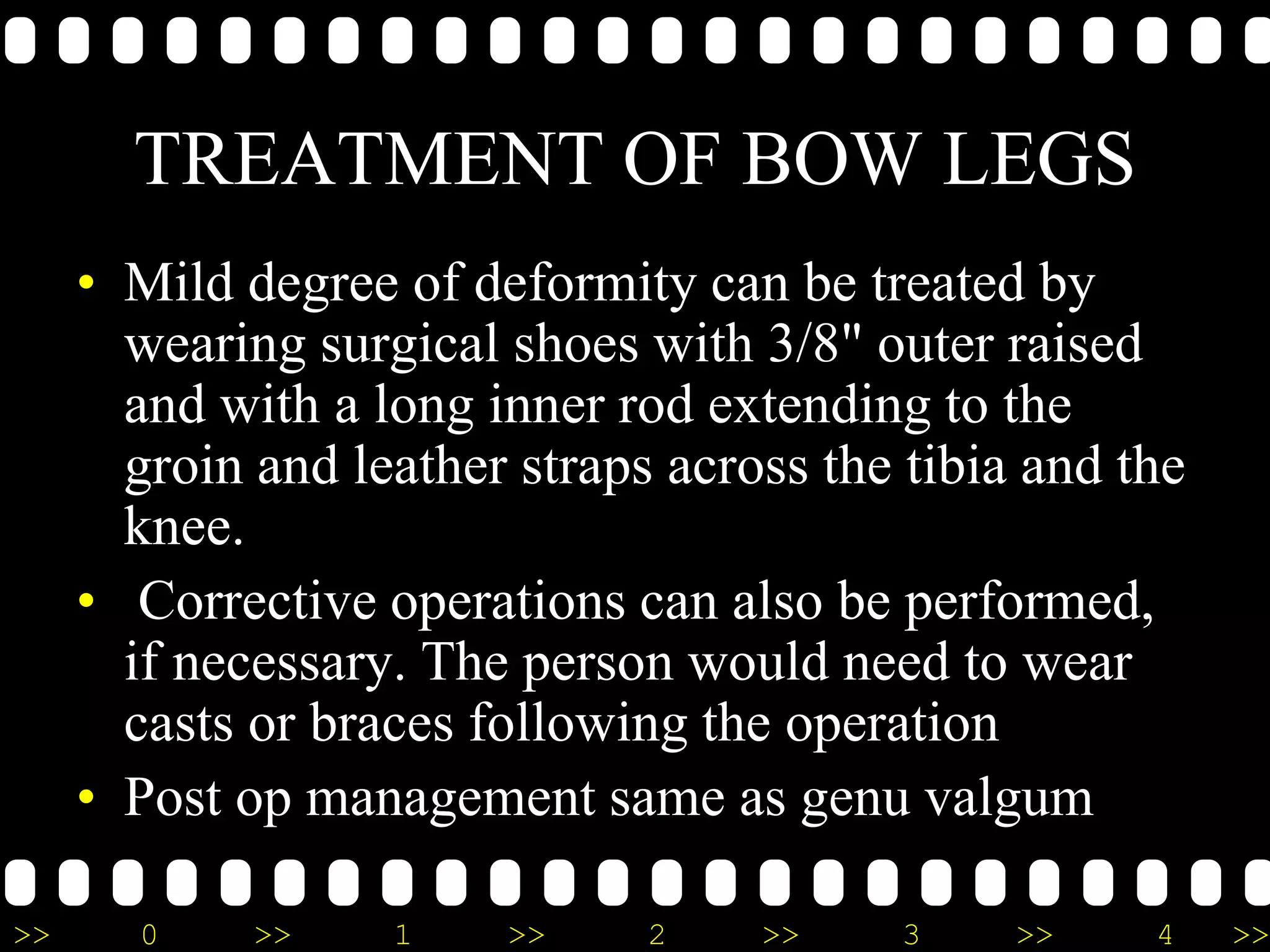 >> 0 >> 1 >> 2 >> 3 >> 4 >>
TREATMENT OF BOW LEGS
• Mild degree of deformity can be treated by
wearing surgical shoes with 3/8" outer raised
and with a long inner rod extending to the
groin and leather straps across the tibia and the
knee.
• Corrective operations can also be performed,
if necessary. The person would need to wear
casts or braces following the operation
• Post op management same as genu valgum
 