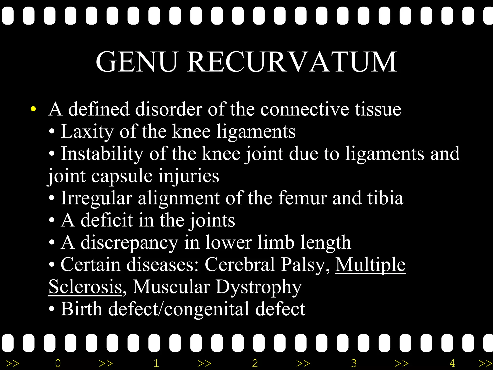 >> 0 >> 1 >> 2 >> 3 >> 4 >>
GENU RECURVATUM
• A defined disorder of the connective tissue
• Laxity of the knee ligaments
• Instability of the knee joint due to ligaments and
joint capsule injuries
• Irregular alignment of the femur and tibia
• A deficit in the joints
• A discrepancy in lower limb length
• Certain diseases: Cerebral Palsy, Multiple
Sclerosis, Muscular Dystrophy
• Birth defect/congenital defect
 