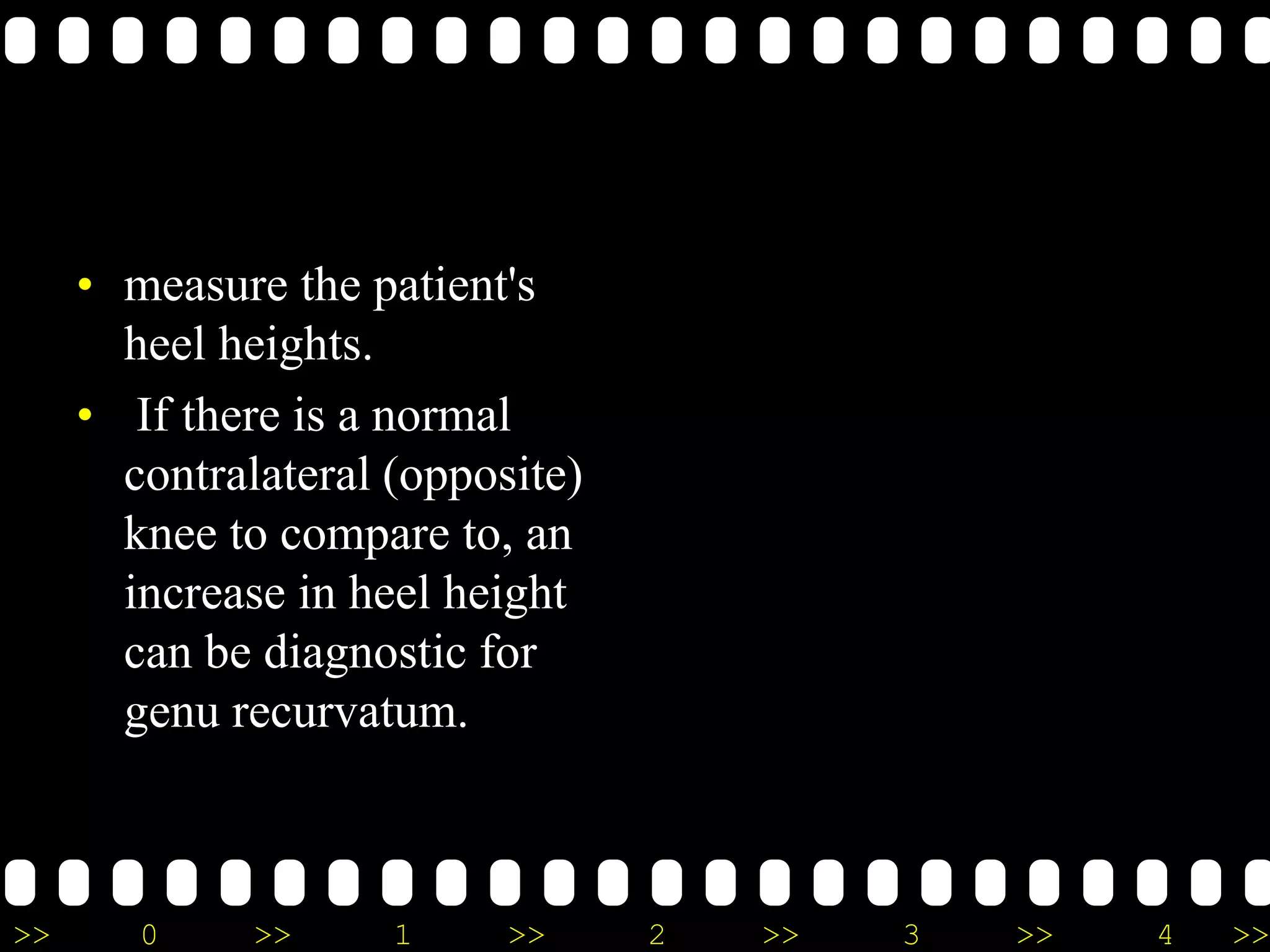 >> 0 >> 1 >> 2 >> 3 >> 4 >>
• measure the patient's
heel heights.
• If there is a normal
contralateral (opposite)
knee to compare to, an
increase in heel height
can be diagnostic for
genu recurvatum.
 