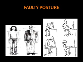 FAULTY POSTURE
 