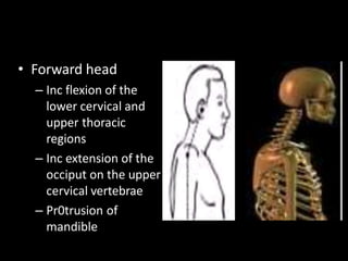 • Forward head
– Inc flexion of the
lower cervical and
upper thoracic
regions
– Inc extension of the
occiput on the upper
cervical vertebrae
– Pr0trusion of
mandible
 