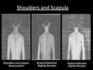 Shoulders and Scapula
Shoulders and scapula
Good position
Scapula Abducted
Slightly Elevated
Scapula Adducted
Slightly Elevated
 